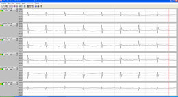 ECG mouse record-resize260x142.bmp