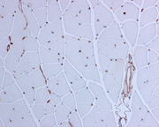 big_Rotated_180_pxl_Lectine_muscle_formol_tamponne_1-100x.jpg